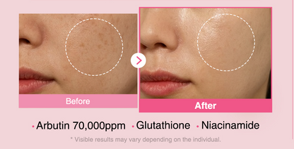 Arbutin 7% + Tranexamic Acid 4% Haneul Glow Cream